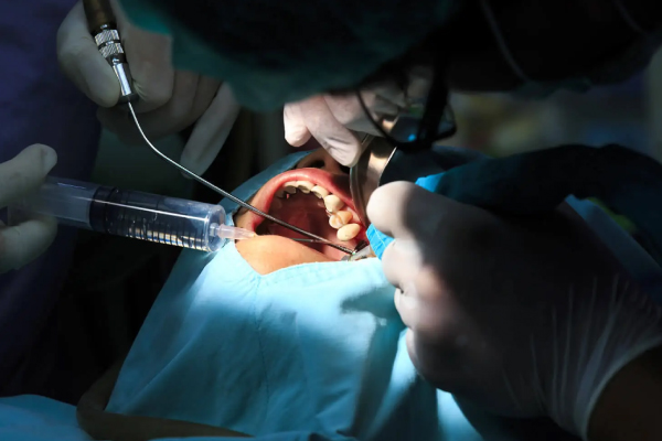 https://titaniumdent.al/wp-content/uploads/2023/05/chirurgia-dentale-small.jpg